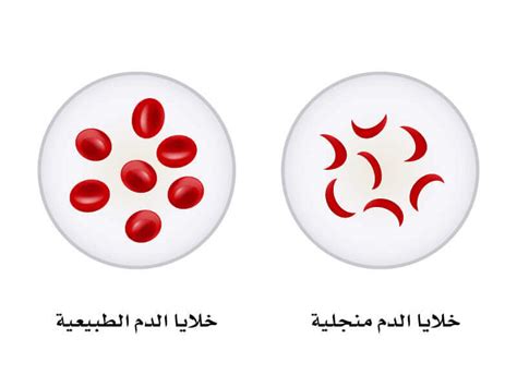 لا تنتقل خلايا الدم الحمراء عبر الغشاء الى سائل